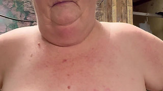 Bad Case of Shingles