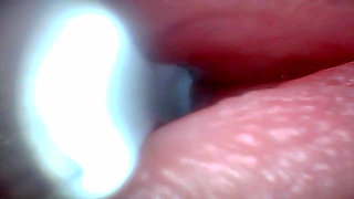 Endoscope Camera Captures Moment of Male Ejaculation 4K