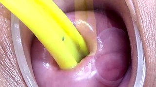 Cervix and Pee Hole Inflation with Injections for Japan Les